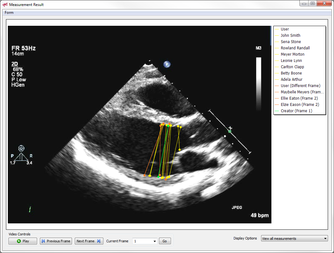 Introduction to Echocardiography Ke Labs